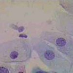 Δοκιμασία οξικού οξέως